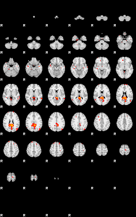 Patients 29174 130