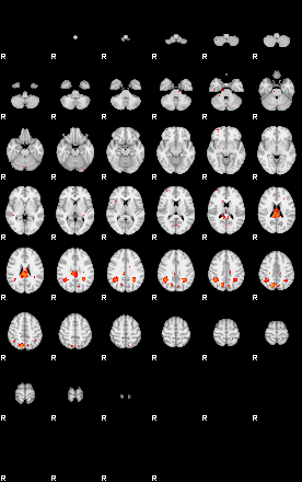 Patients 30014 76