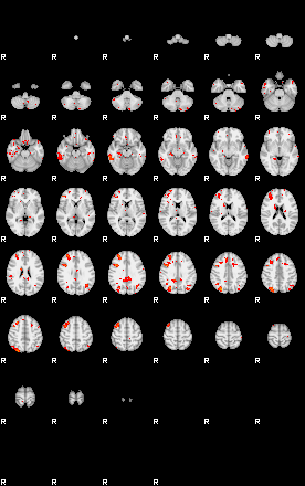 Patients 28995 4