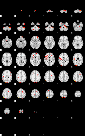 Patients 29039 120