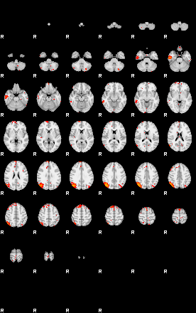 Patients 29507 2