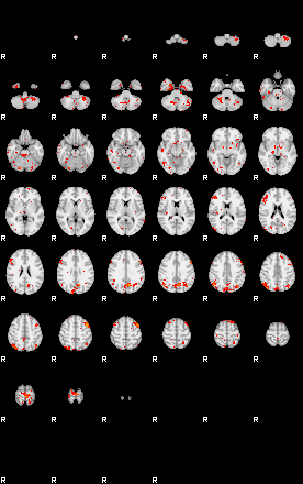 Patients 29613 151