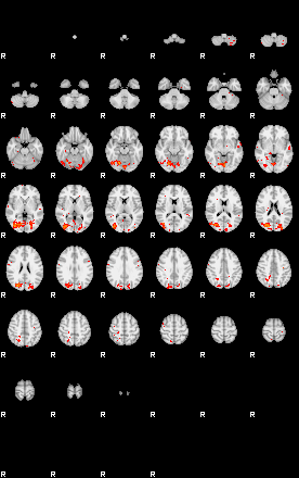 Patients 28940 170