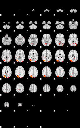 Patients 29161 2