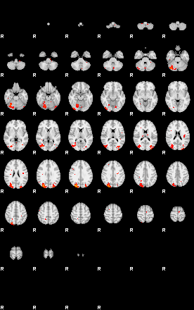 Patients 29183 12