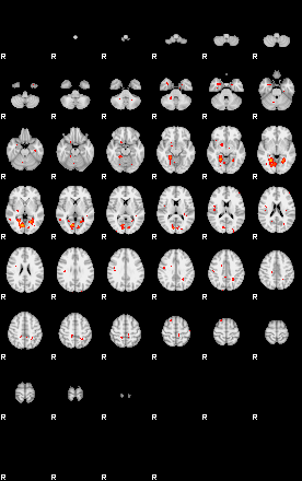 Patients 28718 74