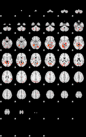 Patients 28930 87