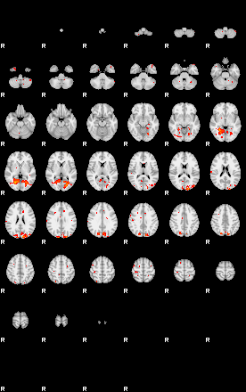 Patients 28952 91