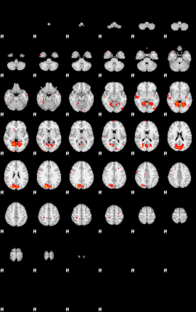 Patients 29027 170