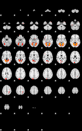 Patients 29059 76