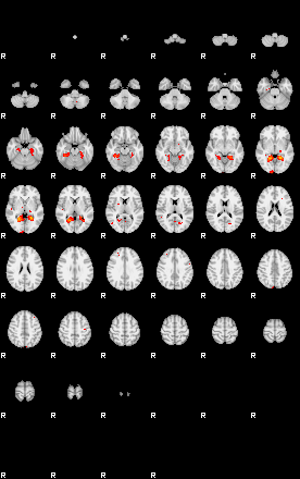 Patients 29111 77