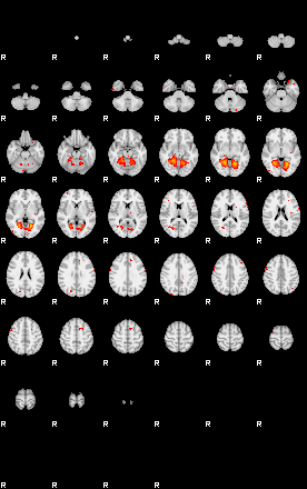 Patients 29174 84