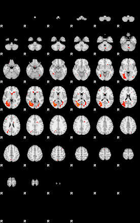 Patients 29178 113