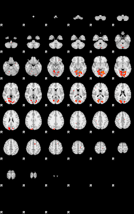 Patients 29187 111