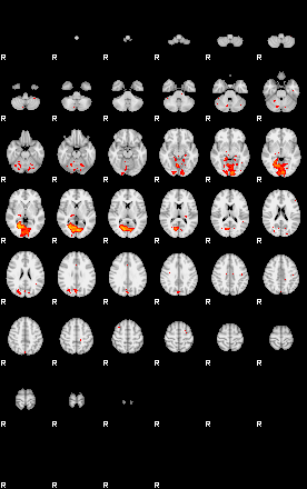 Patients 29200 85