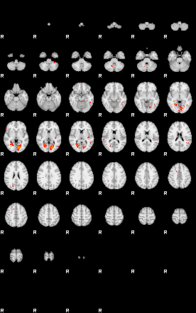 Patients 29204 84