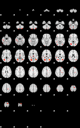 Patients 29275 121