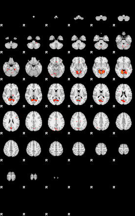 Patients 29566 76