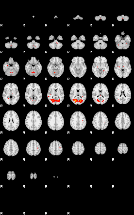 Patients 29660 115