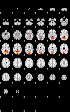 Patients 29676 126