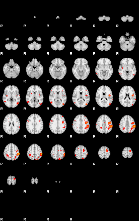 Patients 29156 33