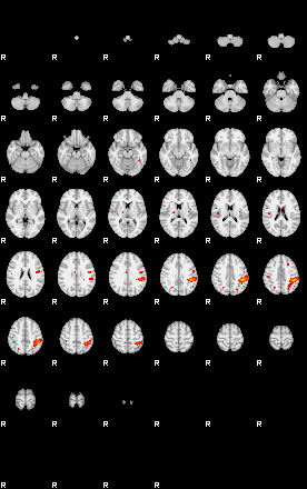 Patients 29162 45