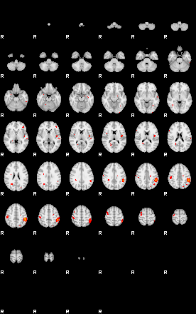 Patients 29167 189