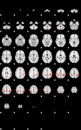 Patients 29185 45