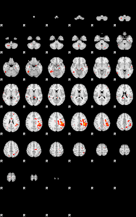 Patients 29280 173