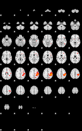 Patients 29434 169