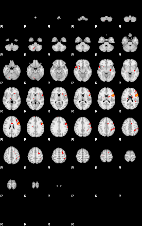 Patients 29112 39