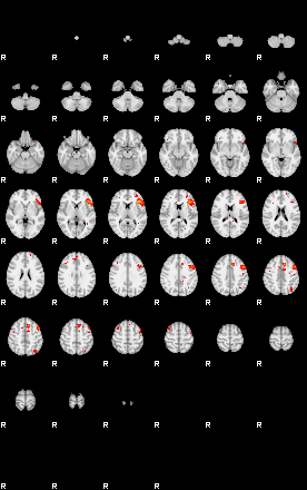 Patients 29155 93