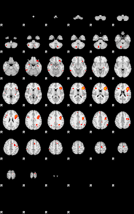 Patients 29160 51