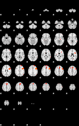 Patients 29162 98