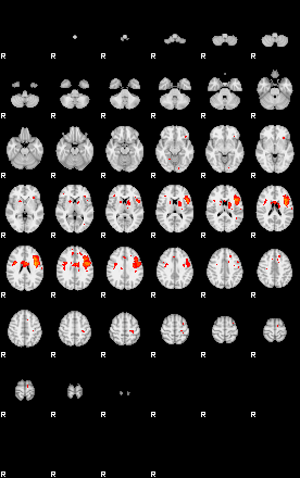 Patients 29164 192