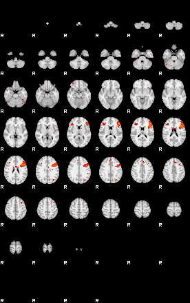 Patients 29175 29