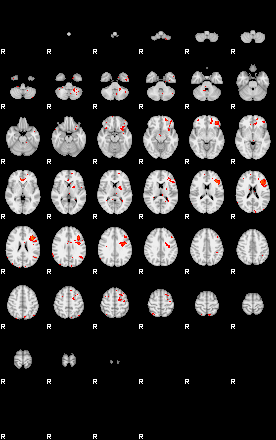 Patients 30151 56