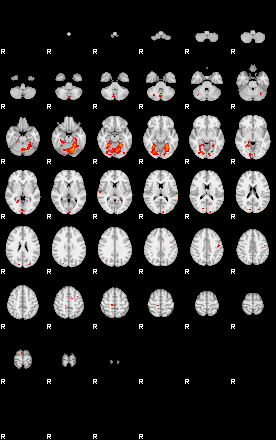 Patients 29100 76