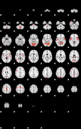 Patients 29549 57