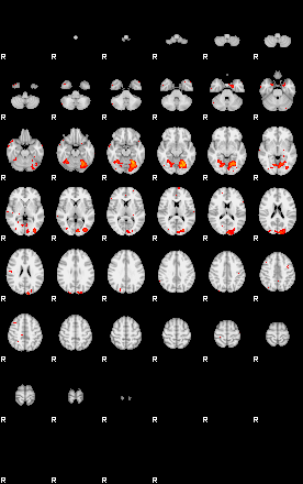 Patients 29730 182