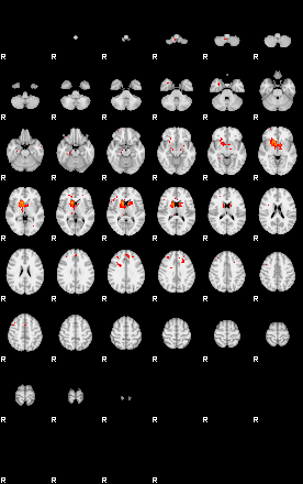 Patients 29055 95