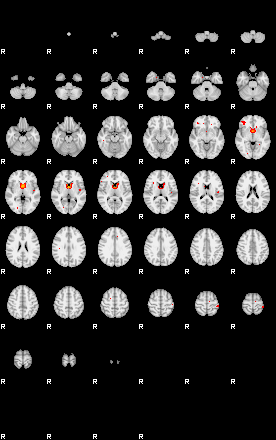 Patients 29161 184