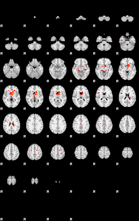 Patients 29166 188