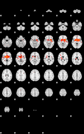 Patients 29176 163