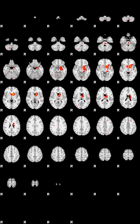 Patients 29189 153