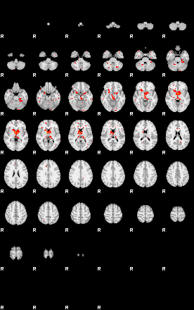 Patients 29509 87