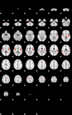 Patients 28997 91