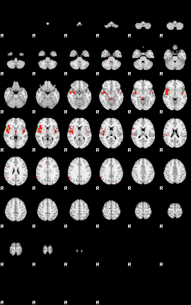 Patients 29012 166