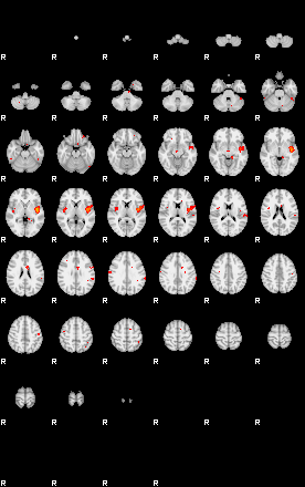 Patients 29213 171