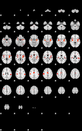 Patients 30017 93